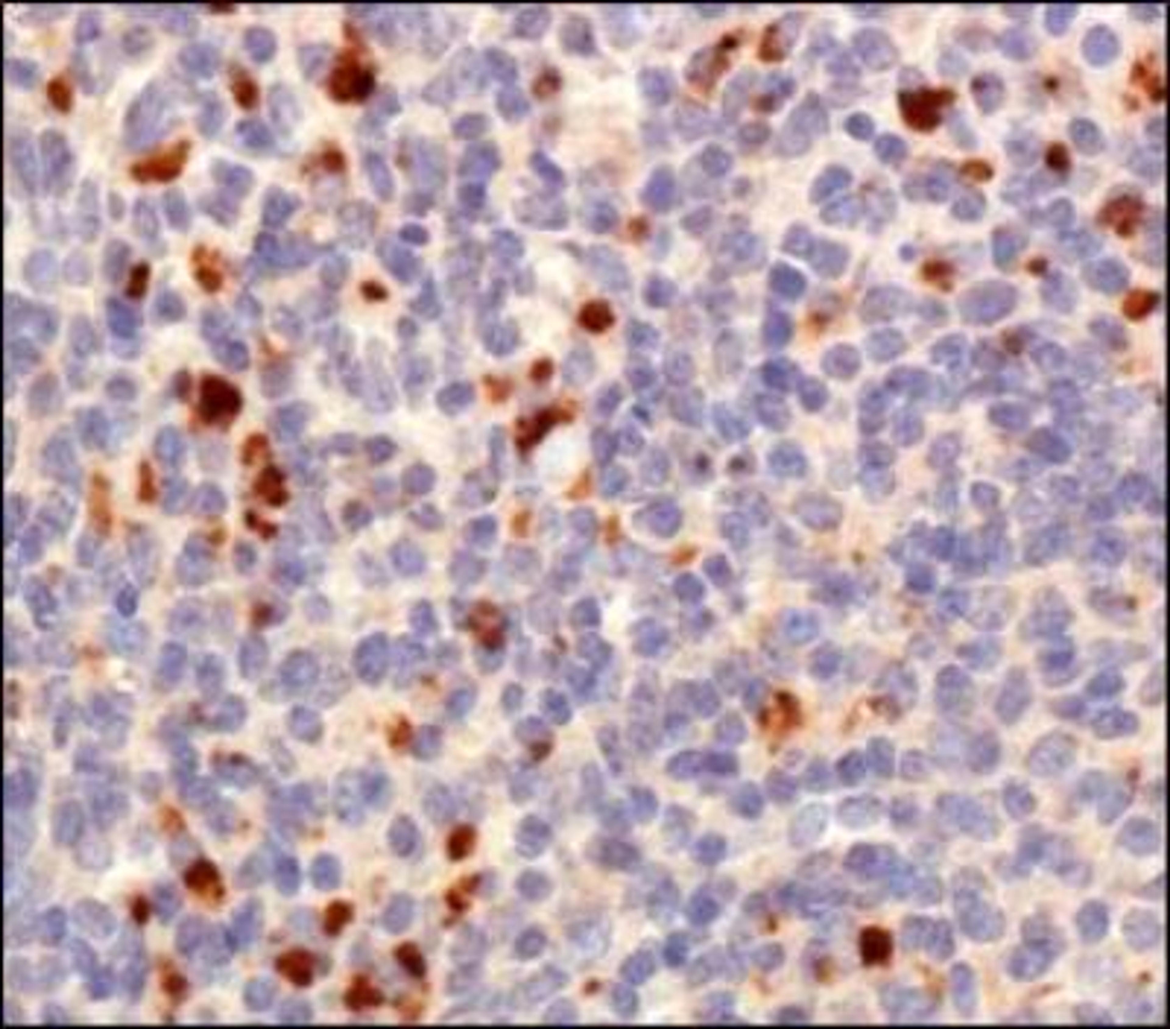 Immunohistochemistry: TET1 Antibody [NBP1-78965] -  IHC analysis of TET1 in mouse spleen using DAB with hematoxylin counterstain.