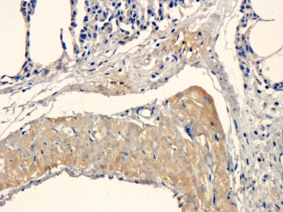 IHC-P staining of rat lung tissue using MCP5 antibody (5 ug/ml)