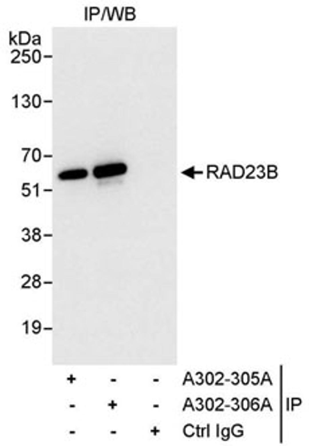 Detection of human RAD23B by western blot of immunoprecipitates.