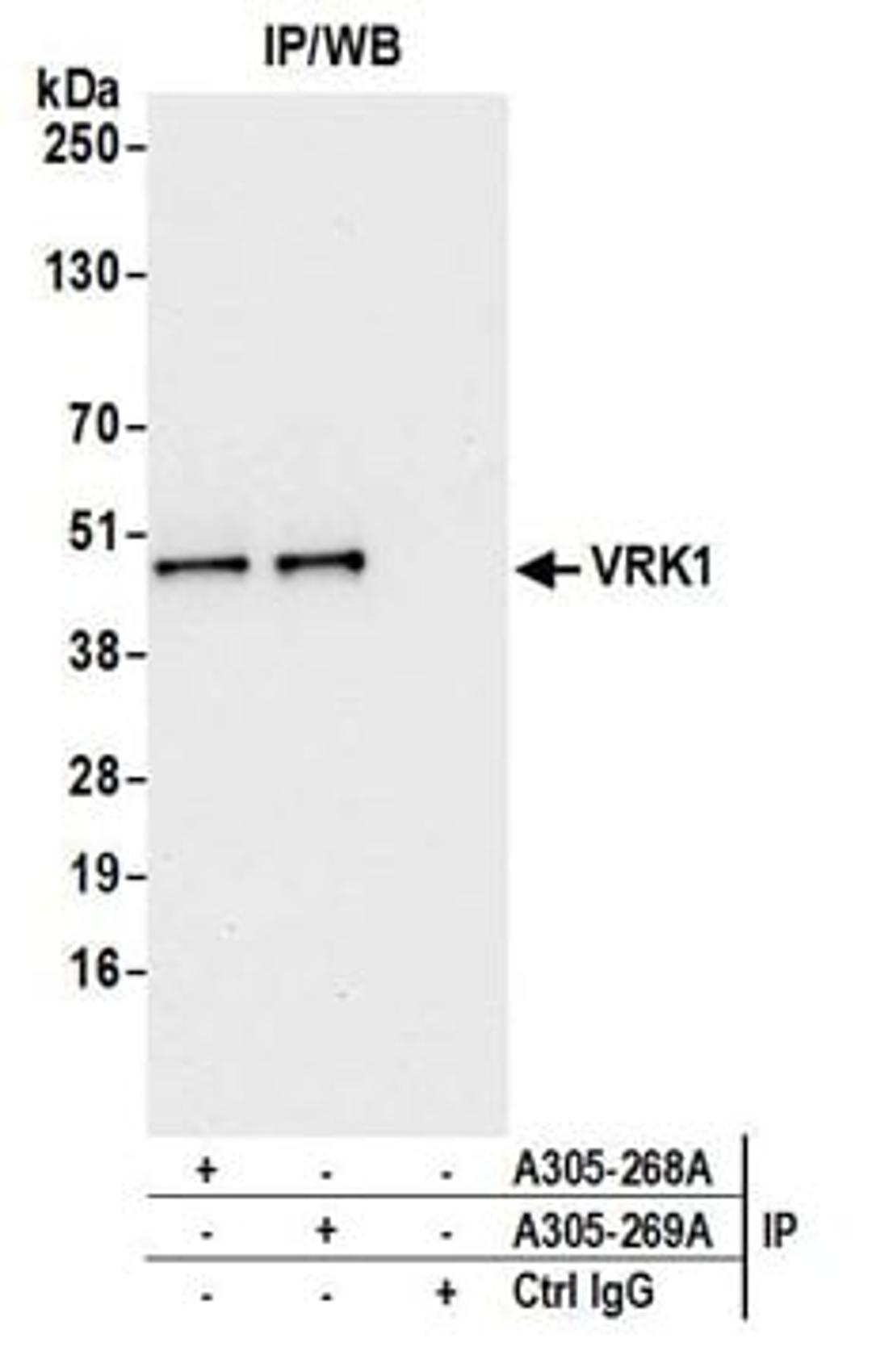 Detection of human VRK1 by western blot of immunoprecipitates.