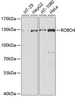 Western blot - ROBO4 antibody (A9876)