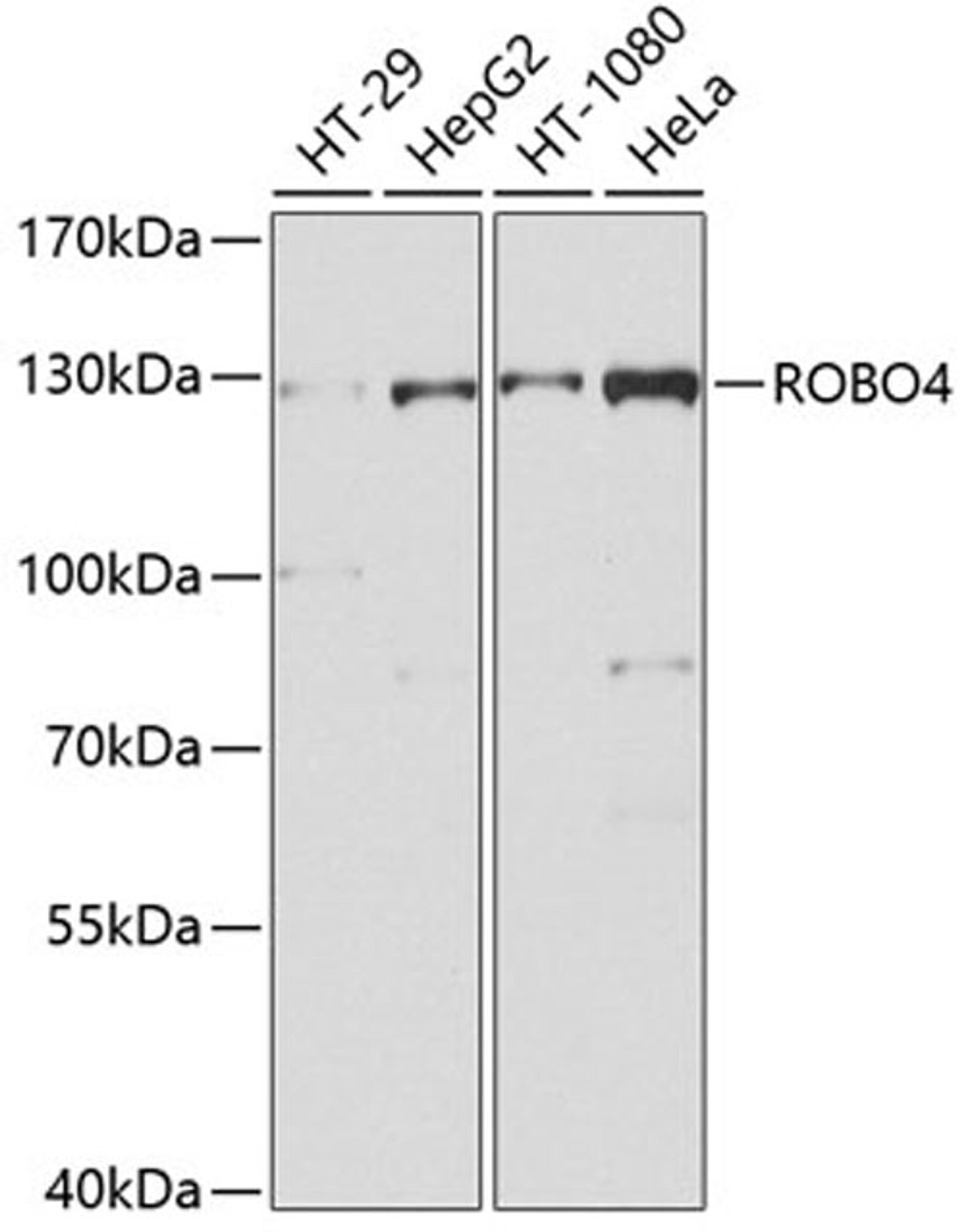 Western blot - ROBO4 antibody (A9876)