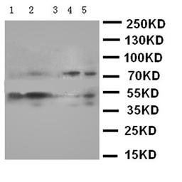 Western blot analysis of Lane 1: K562 Cell Lysate, Lane 2: JURKAT Cell Lysate, Lane 3: PC-12 Cell Lysate, Lane 4: HELA Cell Lysate, Lane 5: SMMC Cell Lysate using SMAD5 antibody