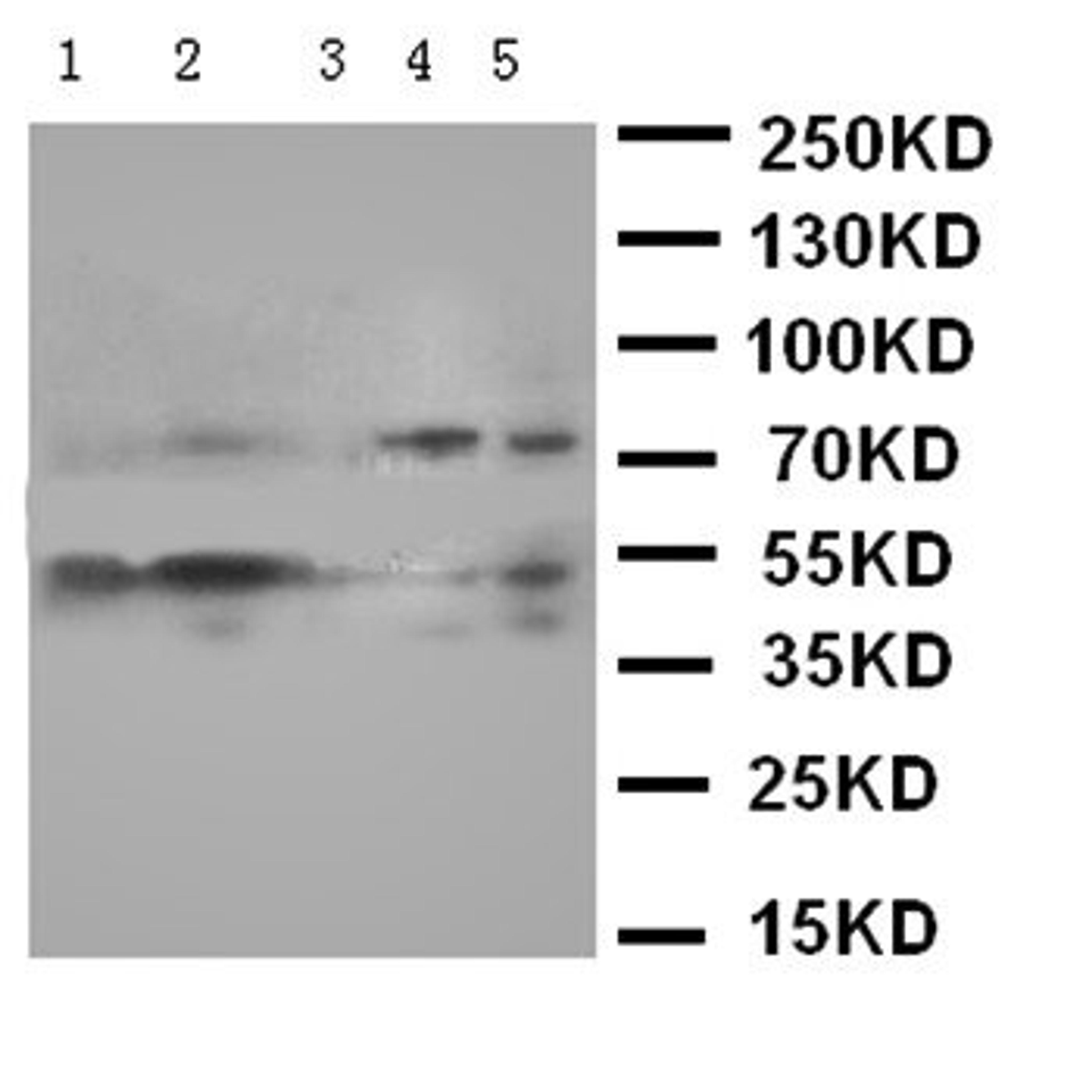 Western blot analysis of Lane 1: K562 Cell Lysate, Lane 2: JURKAT Cell Lysate, Lane 3: PC-12 Cell Lysate, Lane 4: HELA Cell Lysate, Lane 5: SMMC Cell Lysate using SMAD5 antibody