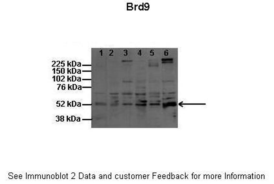 Antibody used in WB on Mouse, Rat: 1:200 (Lanes: 1: 60ug mouse melanocytes (melba), 2: 60ug mouse melanoma (B16), 3: 60ug human melanocytes (HFSC), 4: 60ug human melanoma (SK-MEL5), 5: 60ug human melanoma (YUMAC), 6: 60ug rat shwann cell).