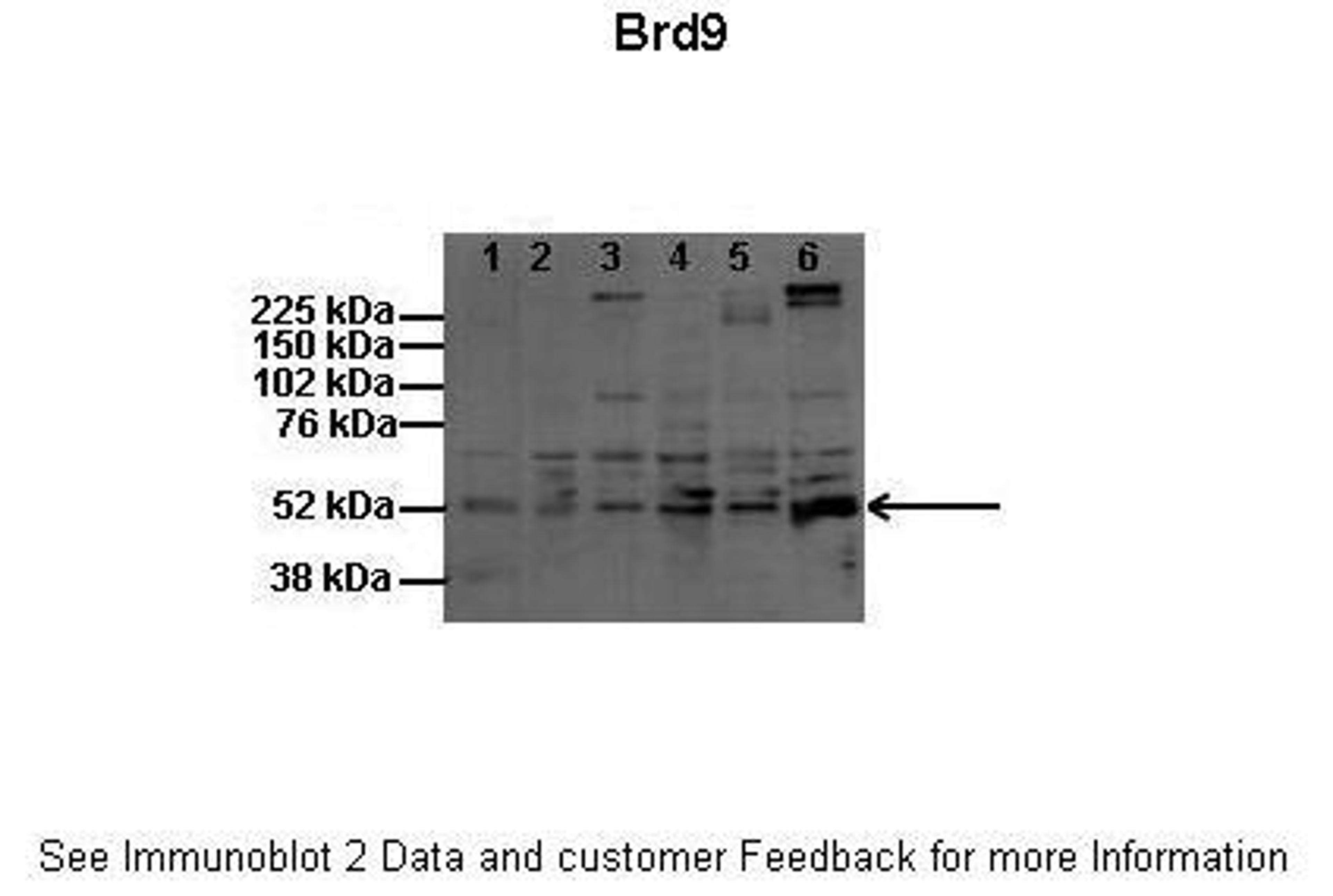 Antibody used in WB on Mouse, Rat: 1:200 (Lanes: 1: 60ug mouse melanocytes (melba), 2: 60ug mouse melanoma (B16), 3: 60ug human melanocytes (HFSC), 4: 60ug human melanoma (SK-MEL5), 5: 60ug human melanoma (YUMAC), 6: 60ug rat shwann cell).