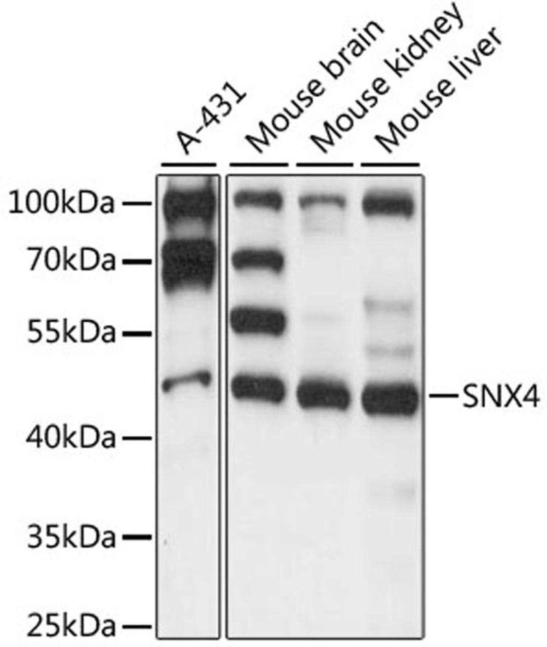 Western blot - SNX4 antibody (A15342)