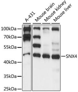 Western blot - SNX4 antibody (A15342)