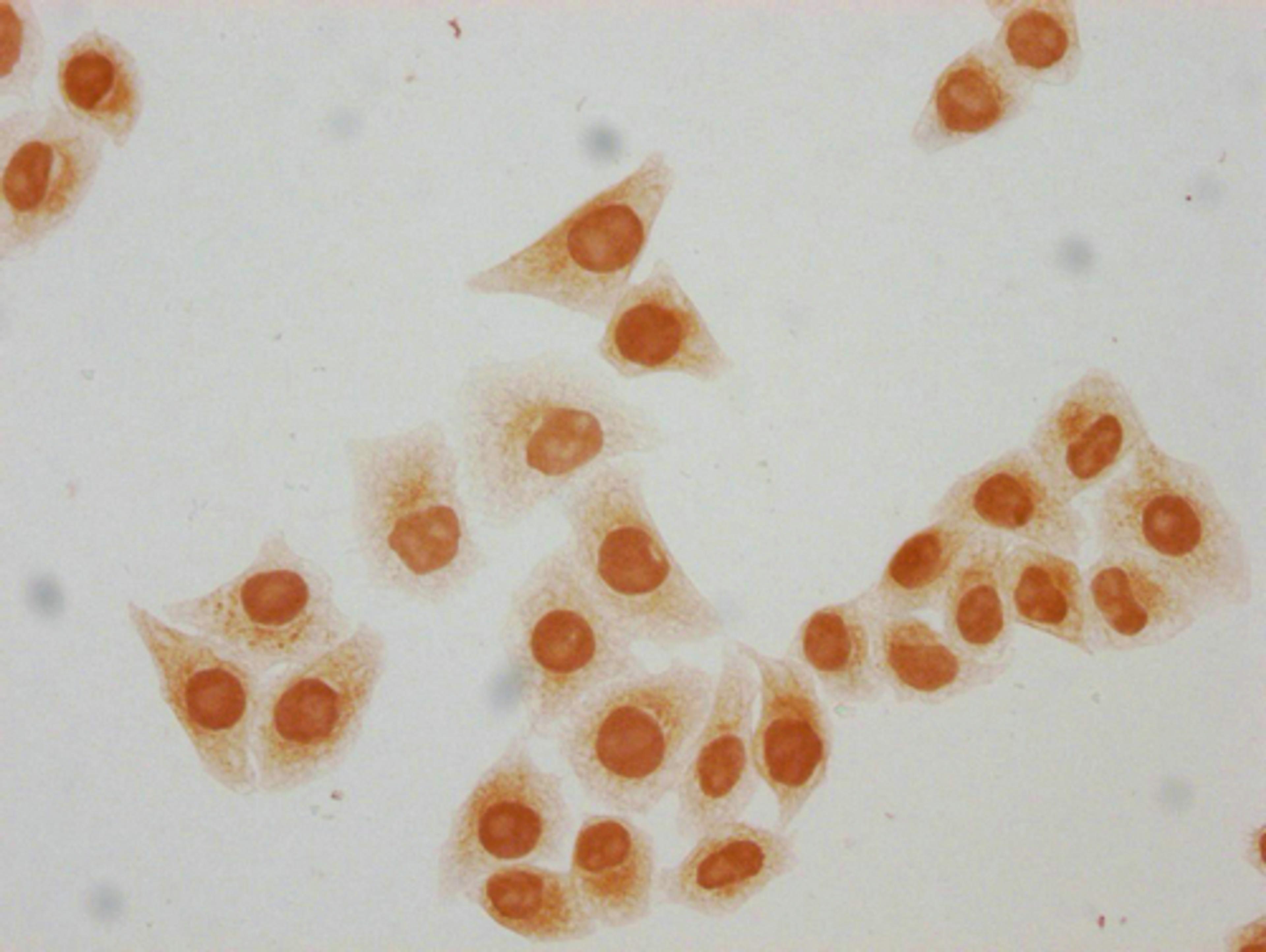 Immunocytochemistry analysis of CSB-PA010418PA64acHU diluted at 1:10 and staining in Hela cells(treated with 30mM sodium butyrate for 4h) performed on a Leica BondTM system. The cells were fixed in 4% formaldehyde, permeabilized using 0.2% Triton X-100 and blocked with 10% normal goat serum 30min at RT. Then primary antibody (1% BSA) was incubated at 4°C overnight. The primary is detected by a biotinylated secondary antibody and visualized using an HRP conjugated SP system.