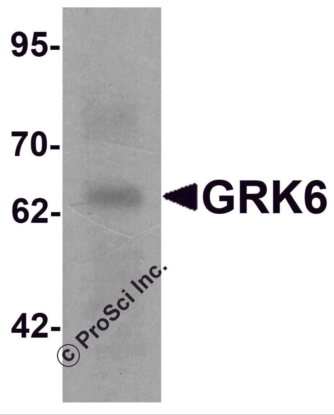 Western blot analysis of GRK6 in rat small intestine tissue lysate with GRK6 antibody at 1 &#956;g/ml.