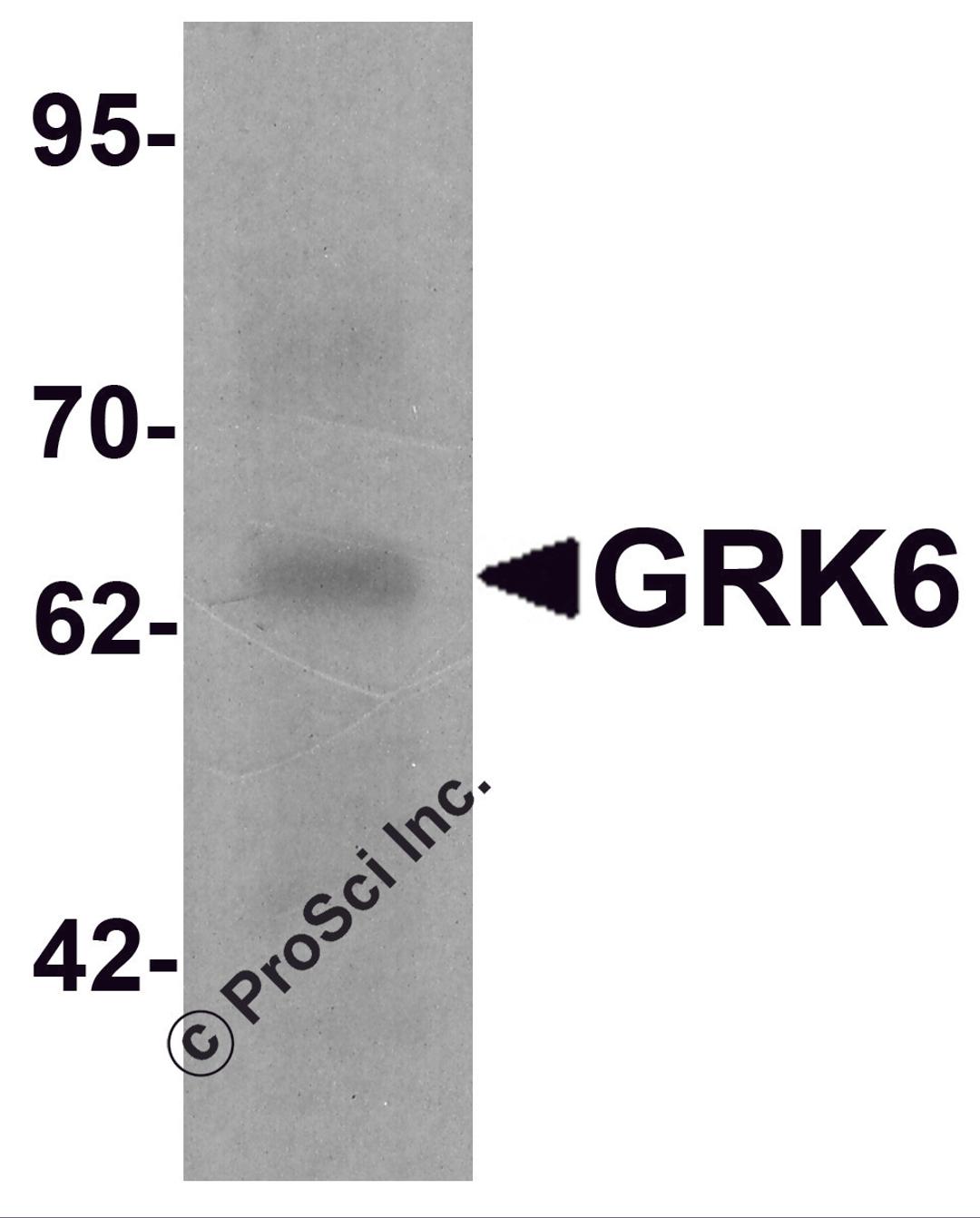 Western blot analysis of GRK6 in rat small intestine tissue lysate with GRK6 antibody at 1 μg/ml.