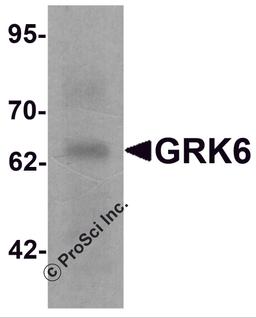 Western blot analysis of GRK6 in rat small intestine tissue lysate with GRK6 antibody at 1 μg/ml.