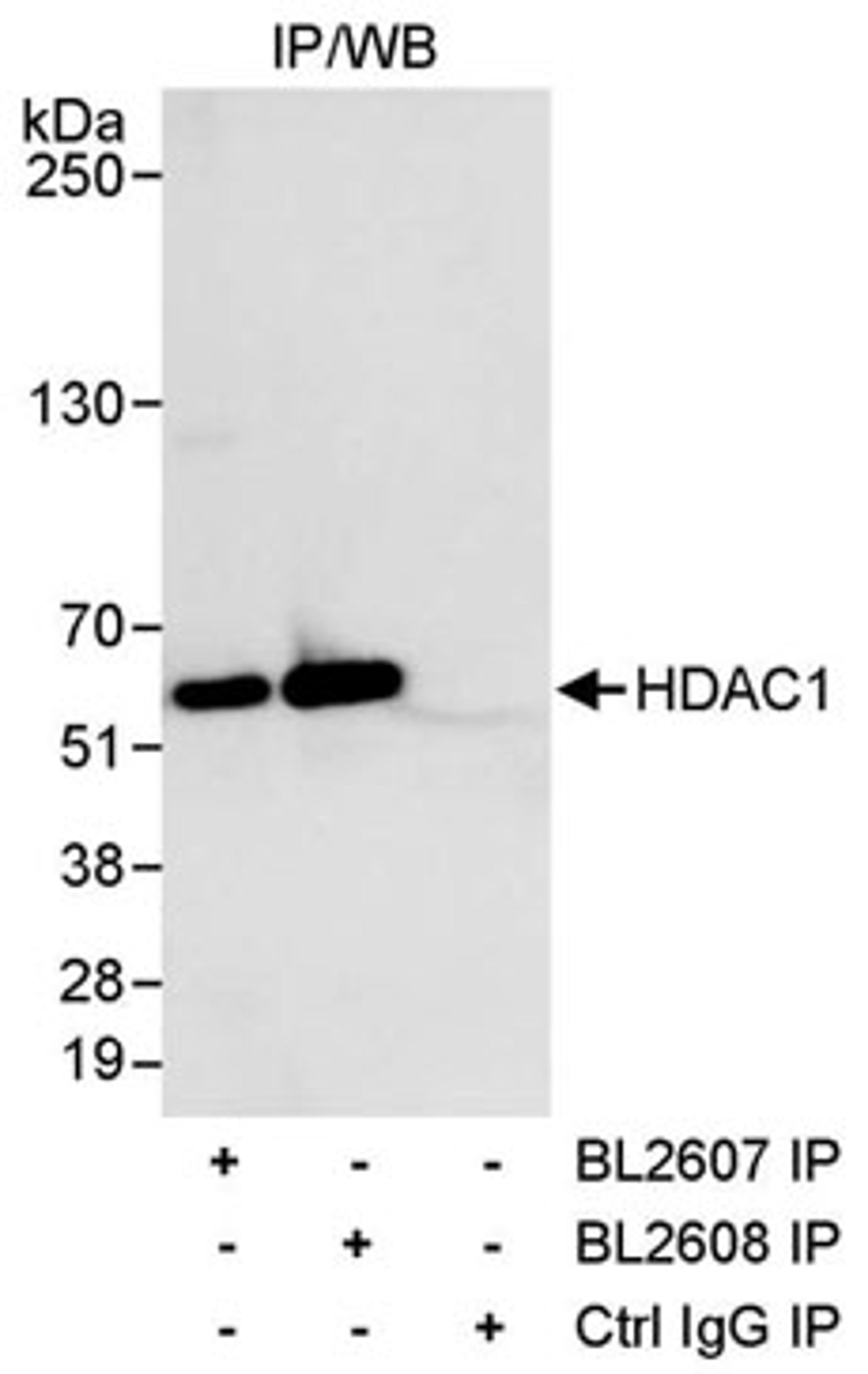 Detection of human HDAC1 by western blot of immunoprecipitates.