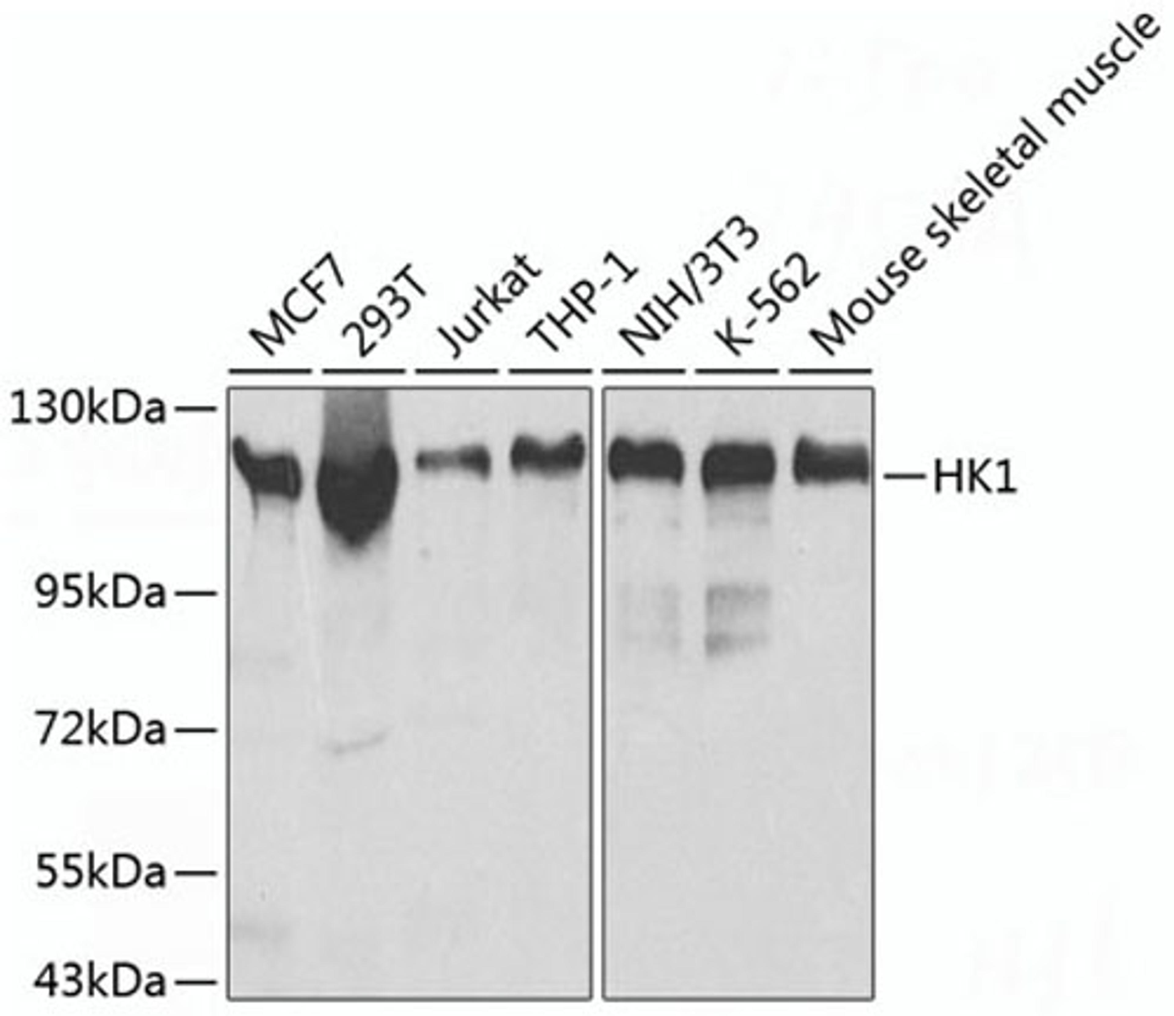 Western blot - HK1 antibody (A1054)