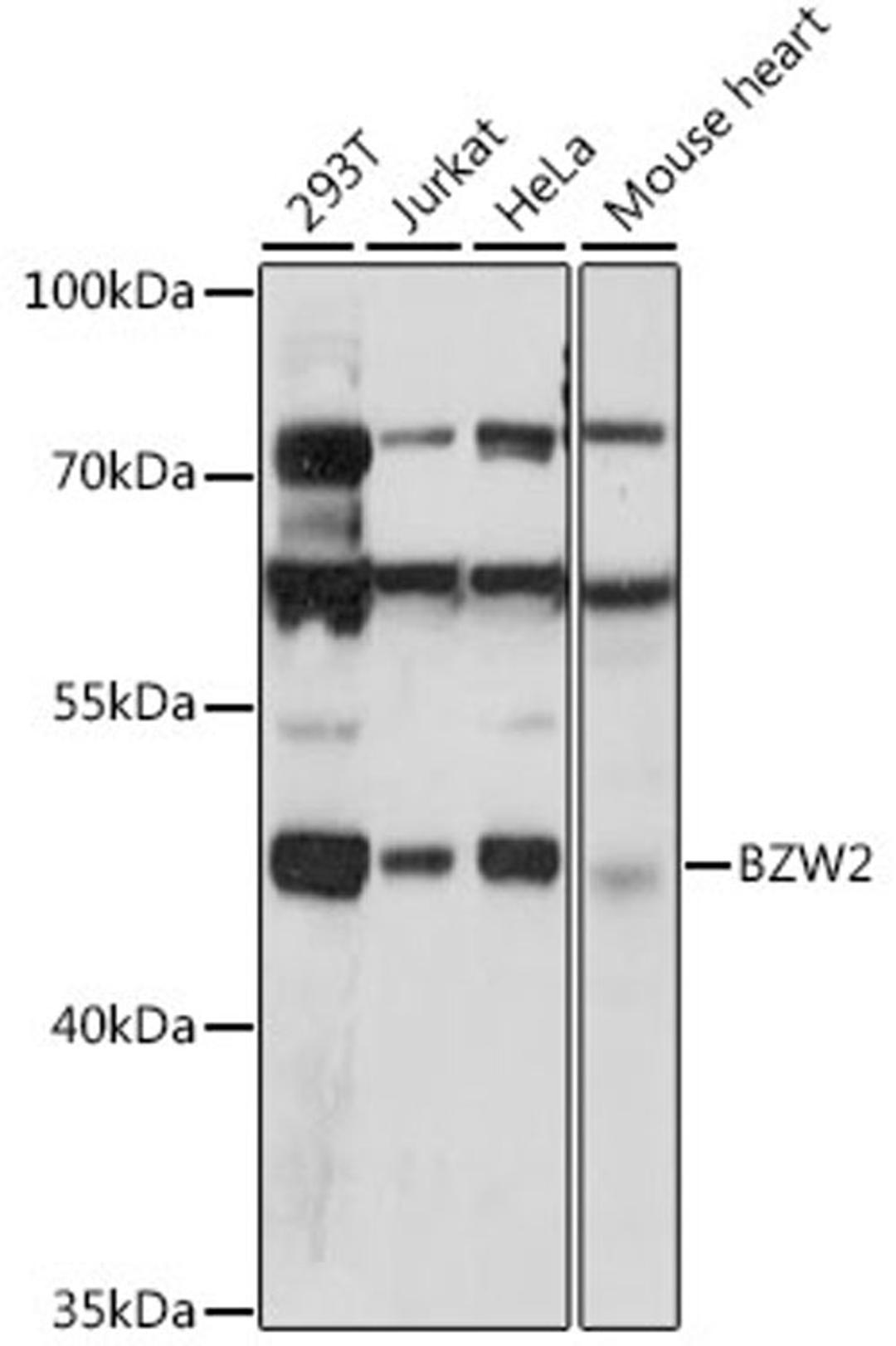 Western blot - BZW2 antibody (A15823)