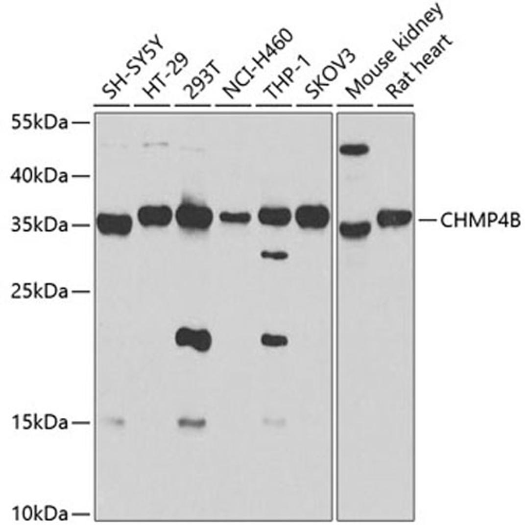 Western blot - CHMP4B antibody (A7402)