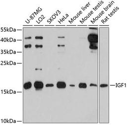 Western blot - IGF1 antibody (A12305)