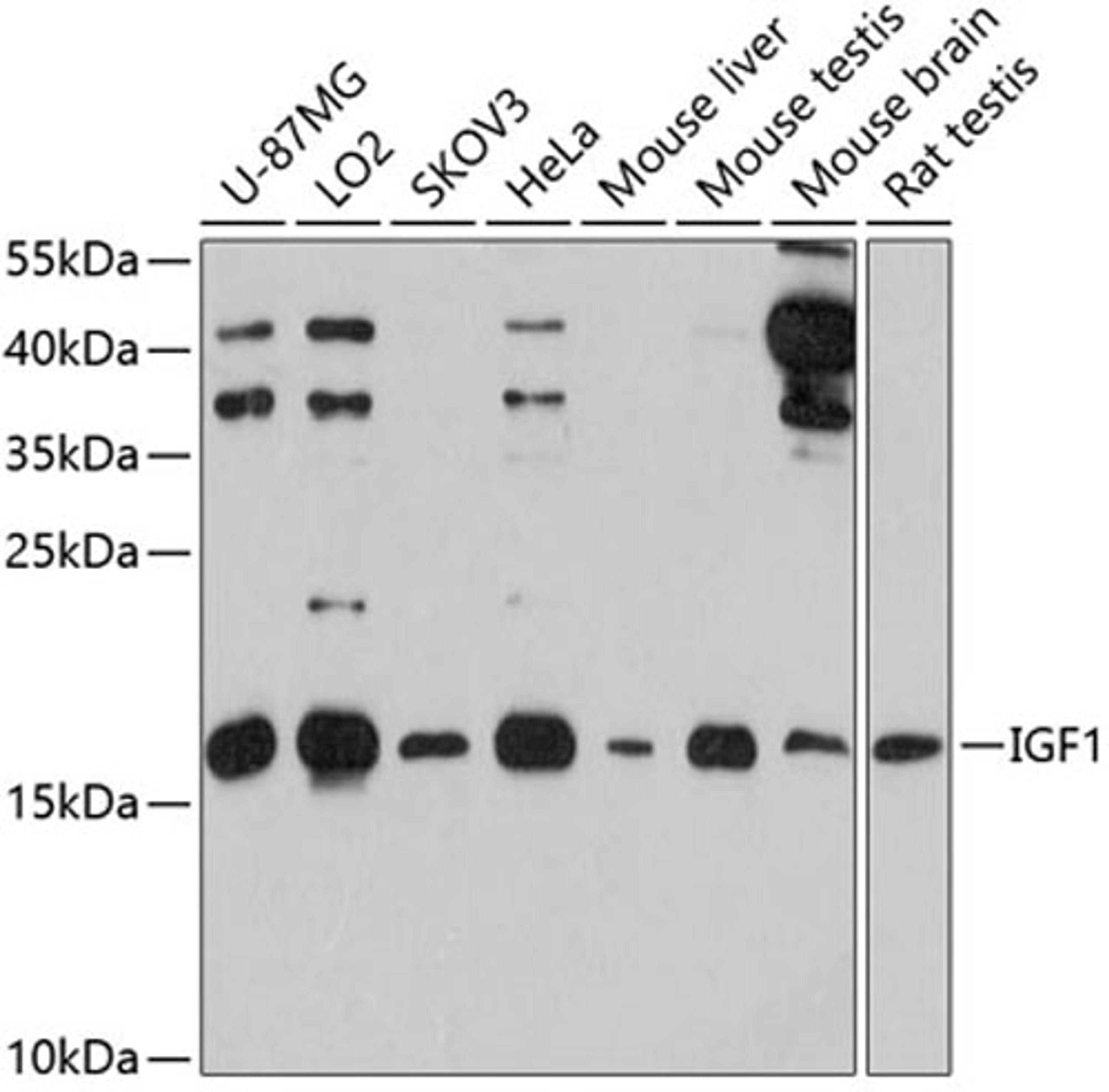 Western blot - IGF1 antibody (A12305)