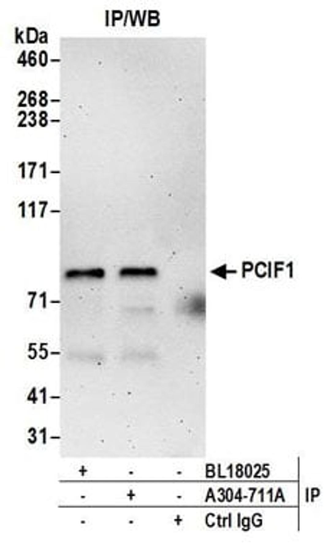 Detection of human PCIF1 by western blot of immunoprecipitates.