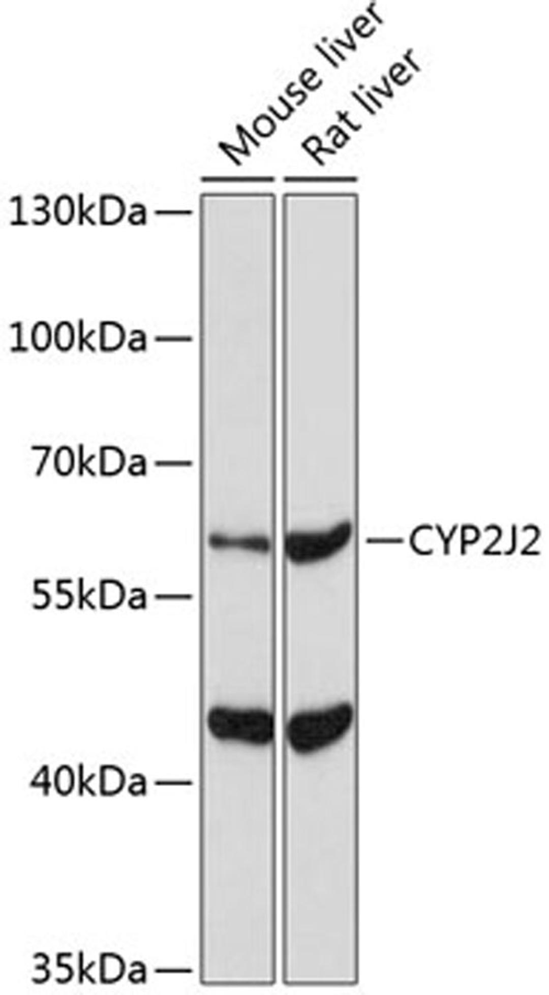 Western blot - CYP2J2 Antibody (A5805)