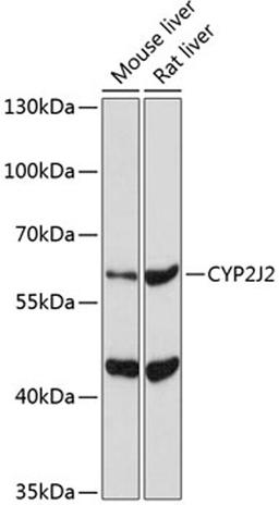 Western blot - CYP2J2 Antibody (A5805)