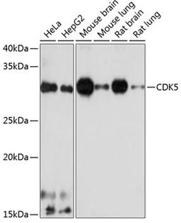 Western blot - CDK5 antibody (A19029)