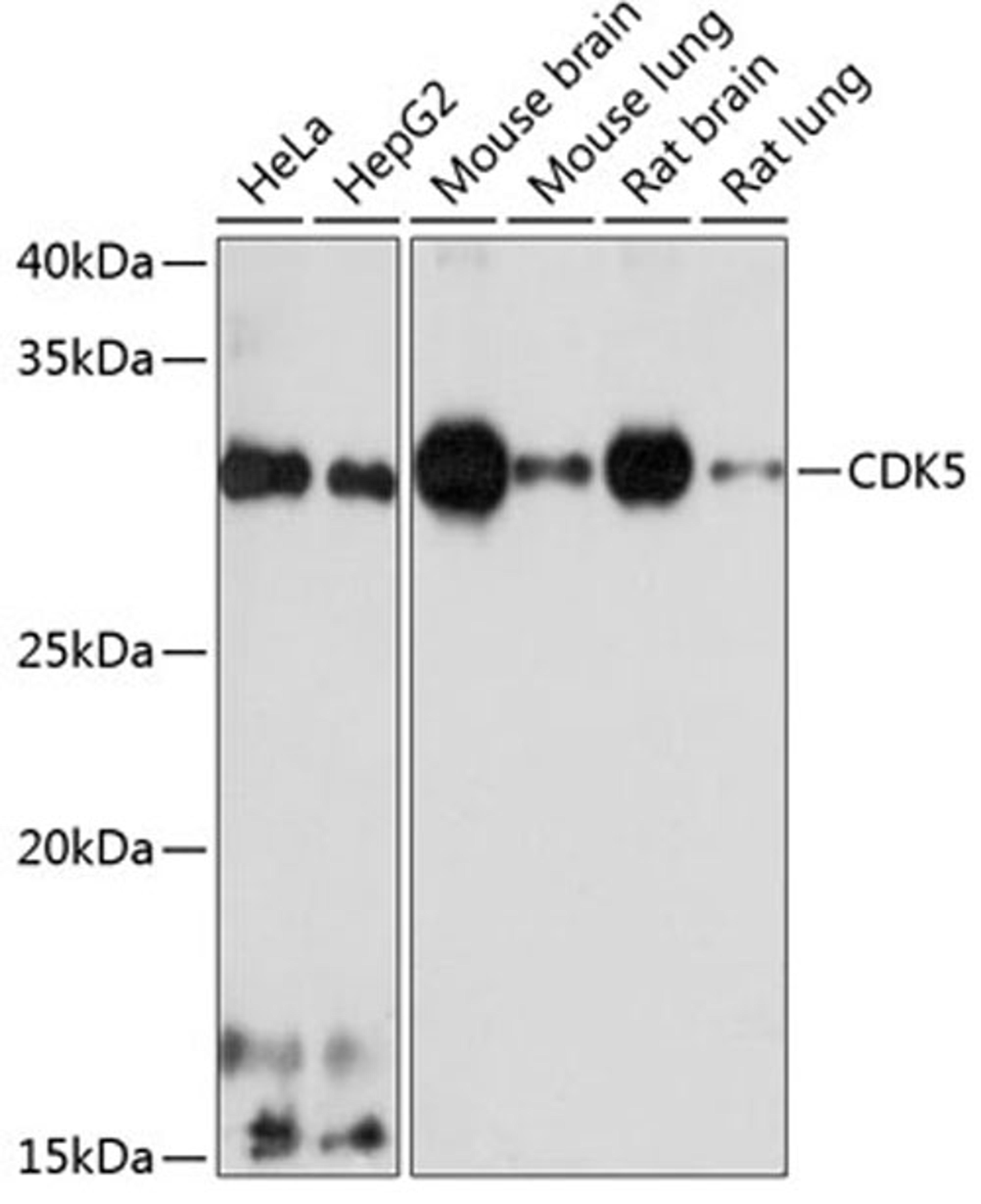 Western blot - CDK5 antibody (A19029)