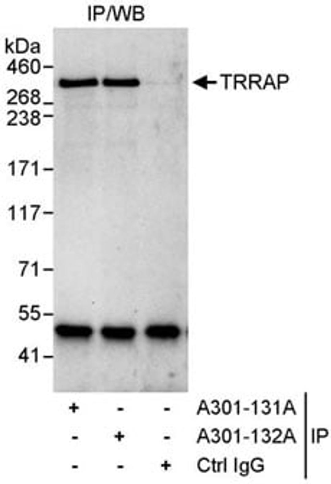 Detection of human TRRAP by western blot of immunoprecipitates.