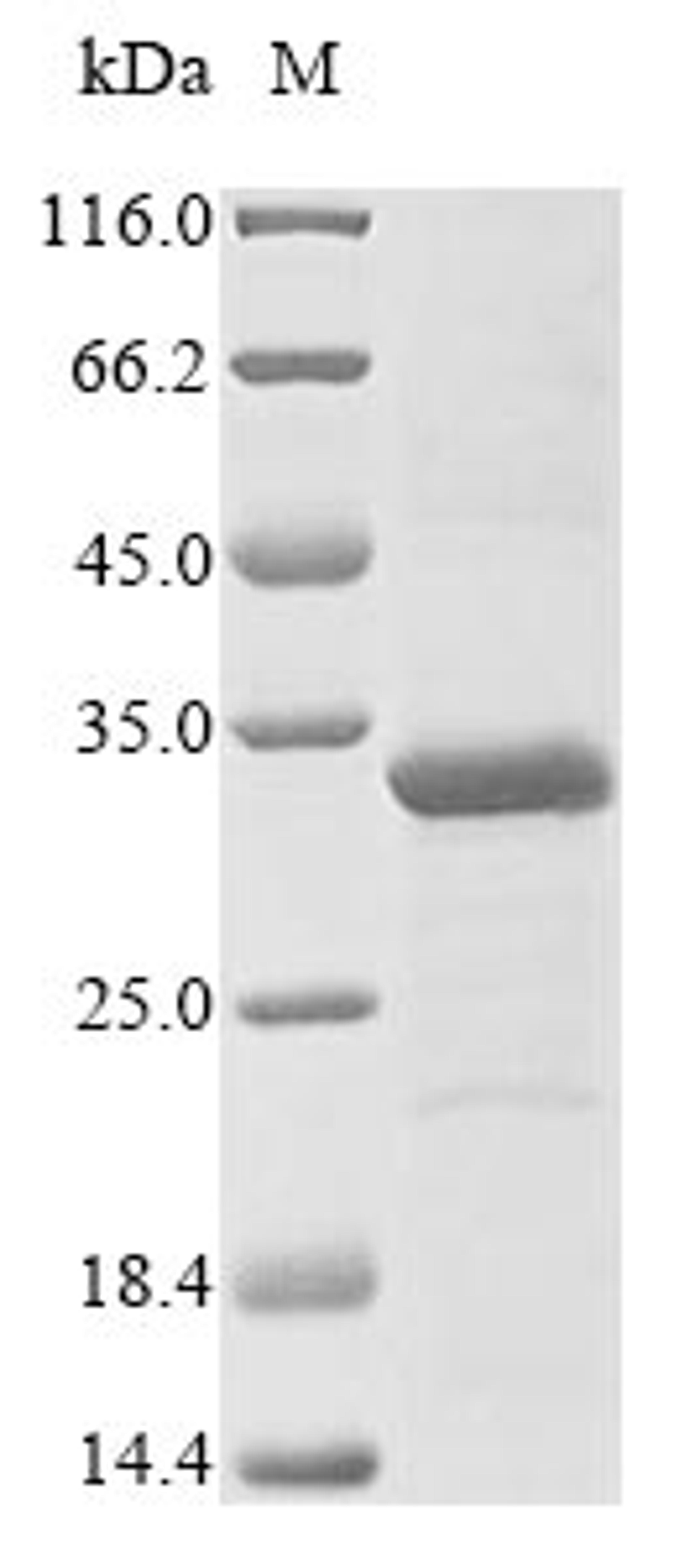 (Tris-Glycine gel) Discontinuous SDS-PAGE (reduced) with 5% enrichment gel and 15% separation gel.