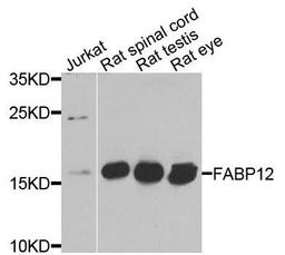 Western blot analysis of extracts of various cells using FABP12 antibody