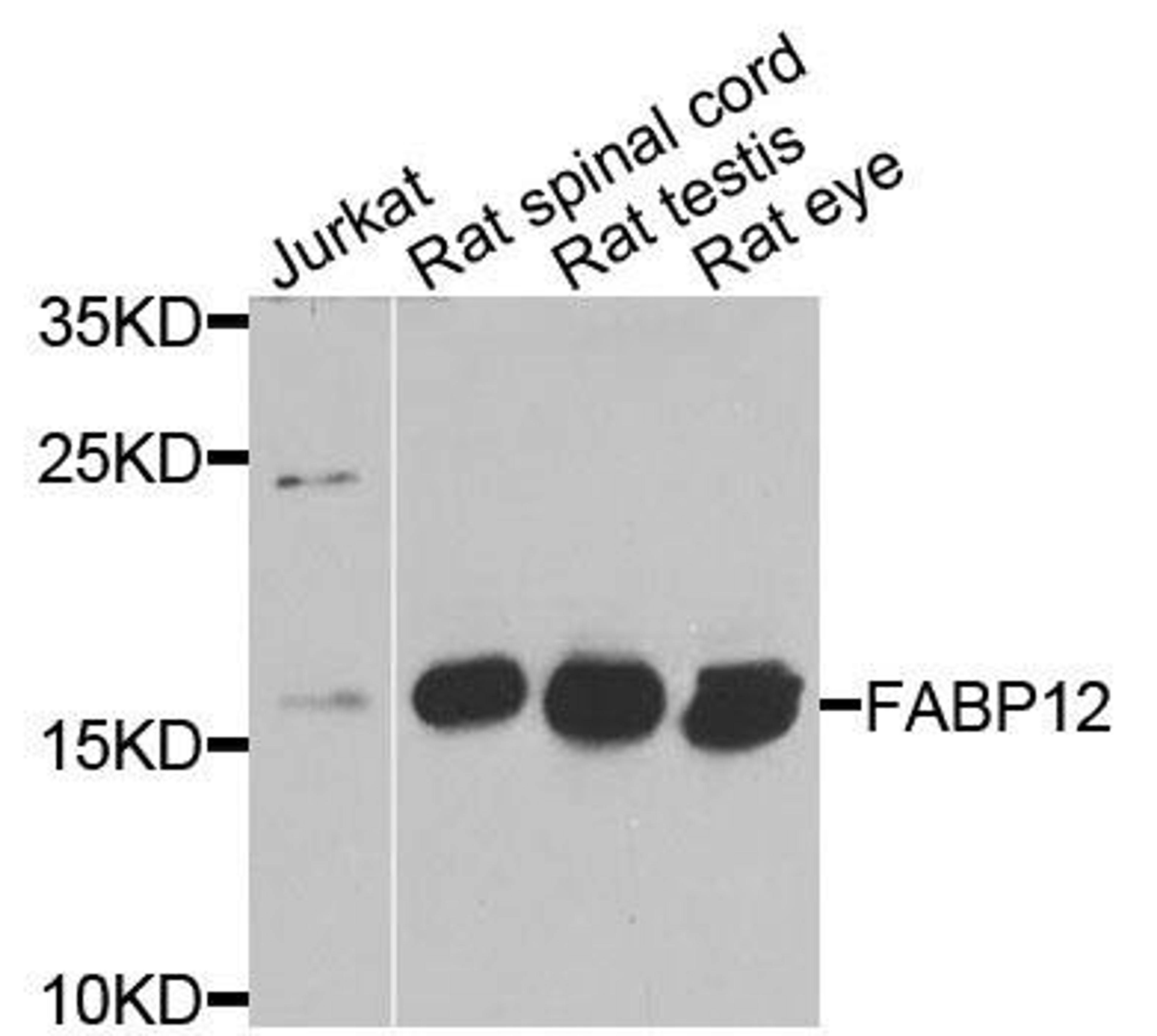 Western blot analysis of extracts of various cells using FABP12 antibody