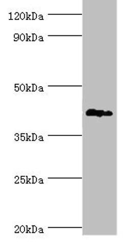 Western blot. All lanes: G/T mismatch-specific thymine DNA glycosylase antibody at 6ug/ml + Mouse brain tissue. Secondary. Goat polyclonal to rabbit IgG at 1/10000 dilution. Predicted band size: 46 kDa. Observed band size: 46 kDa. 