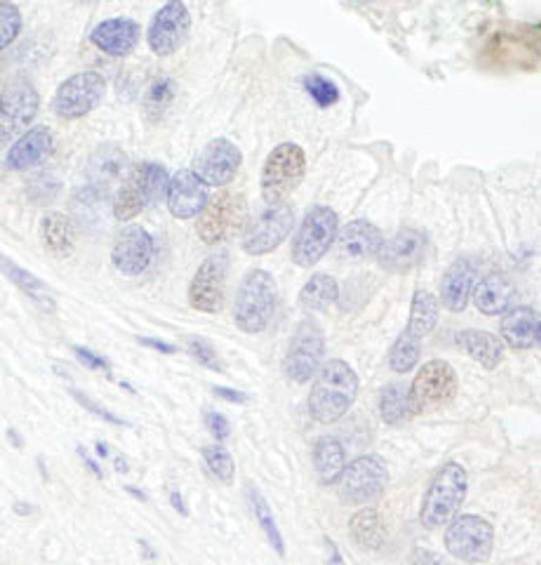 Detection of human GTF3C1/TFIIIC220 by immunohistochemistry.