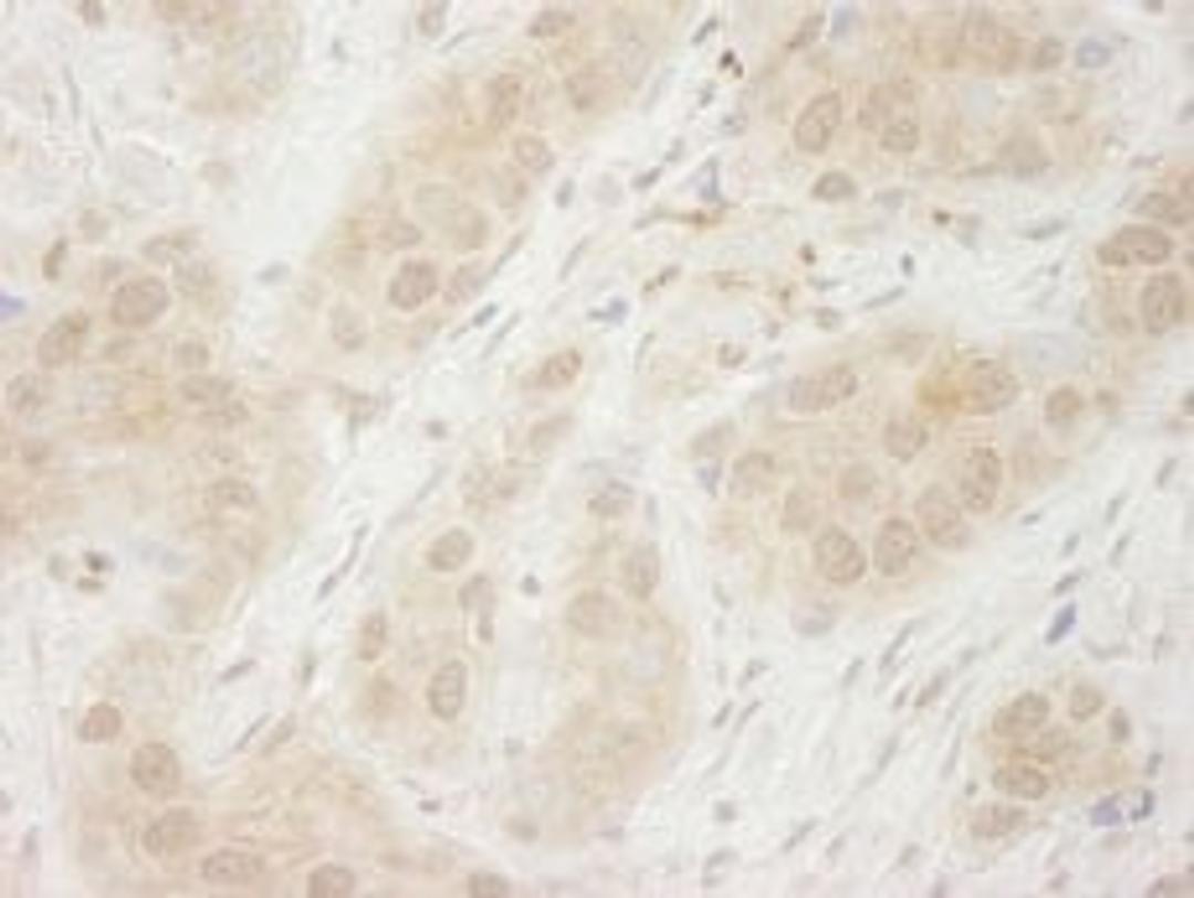 Detection of human SYK by immunohistochemistry.