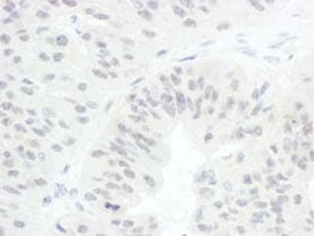 Detection of human CDC20 by immunohistochemistry.