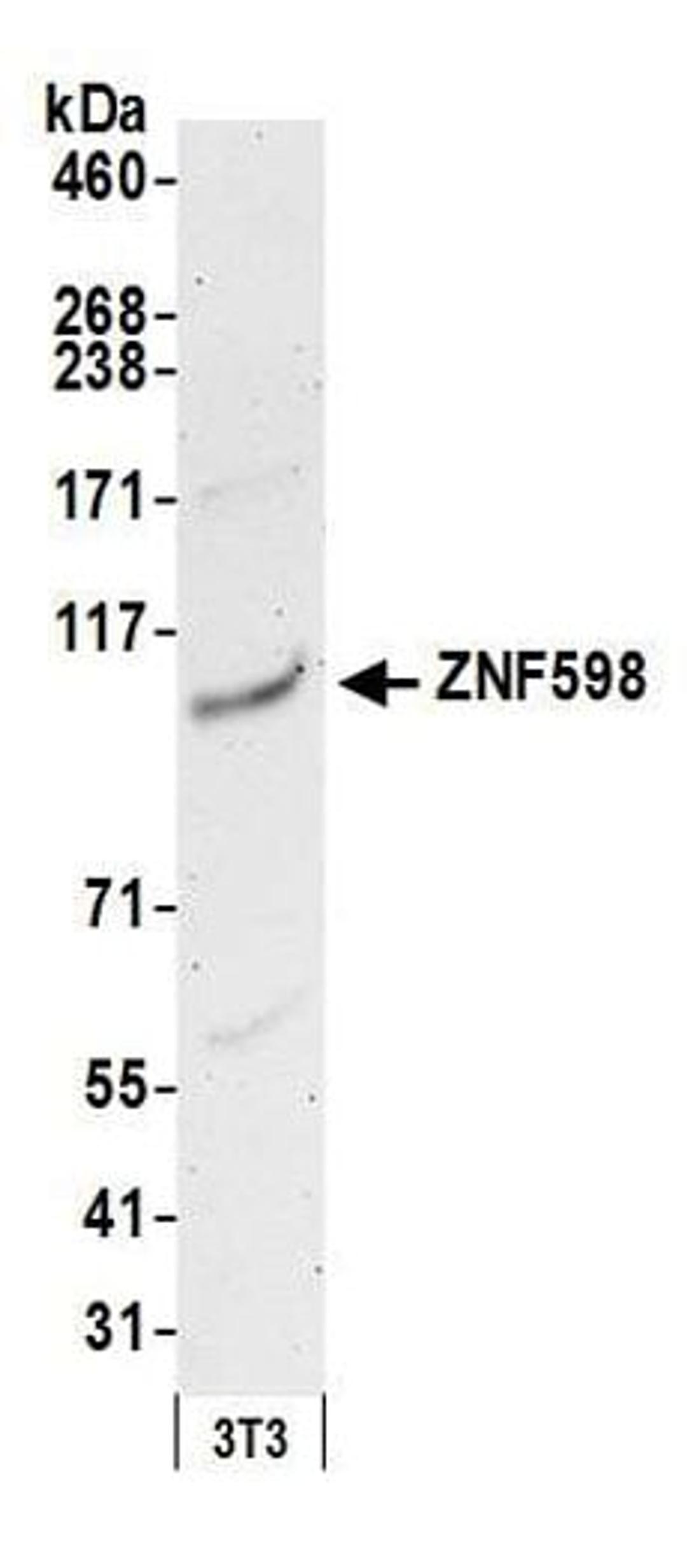 Detection of mouse ZNF598 by western blot.