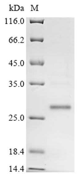 (Tris-Glycine gel) Discontinuous SDS-PAGE (reduced) with 5% enrichment gel and 15% separation gel.