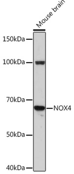 Western blot - NOX4 Rabbit mAb (A3656)