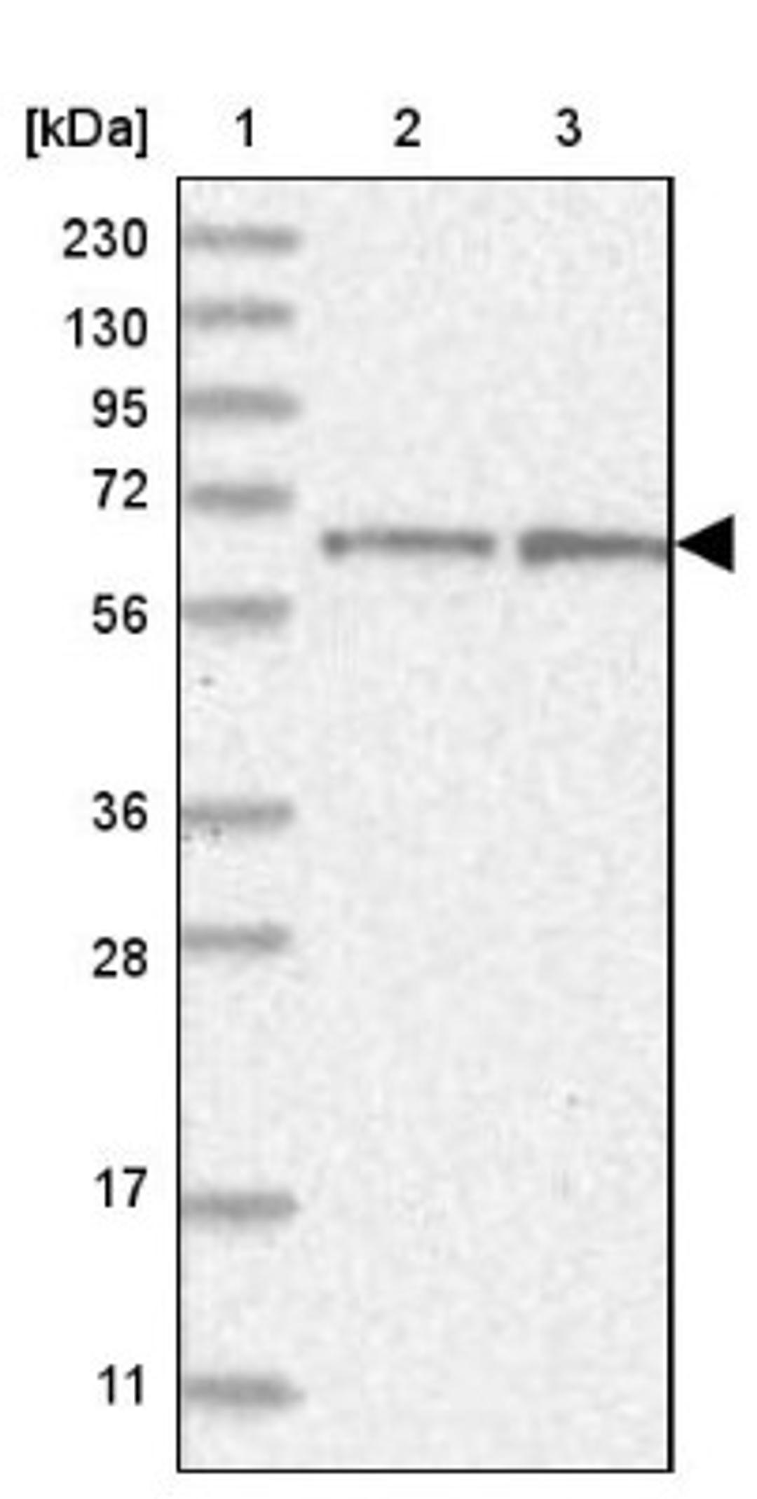 Western Blot: NEU4 Antibody [NBP2-32682] - Lane 1: Marker [kDa] 230, 130, 95, 72, 56, 36, 28, 17, 11<br/>Lane 2: Human cell line RT-4<br/>Lane 3: Human cell line U-251MG sp