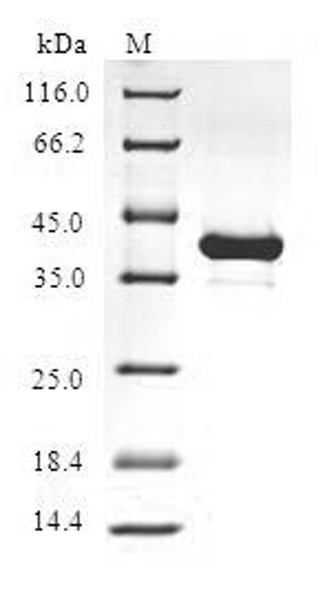(Tris-Glycine gel) Discontinuous SDS-PAGE (reduced) with 5% enrichment gel and 15% separation gel.