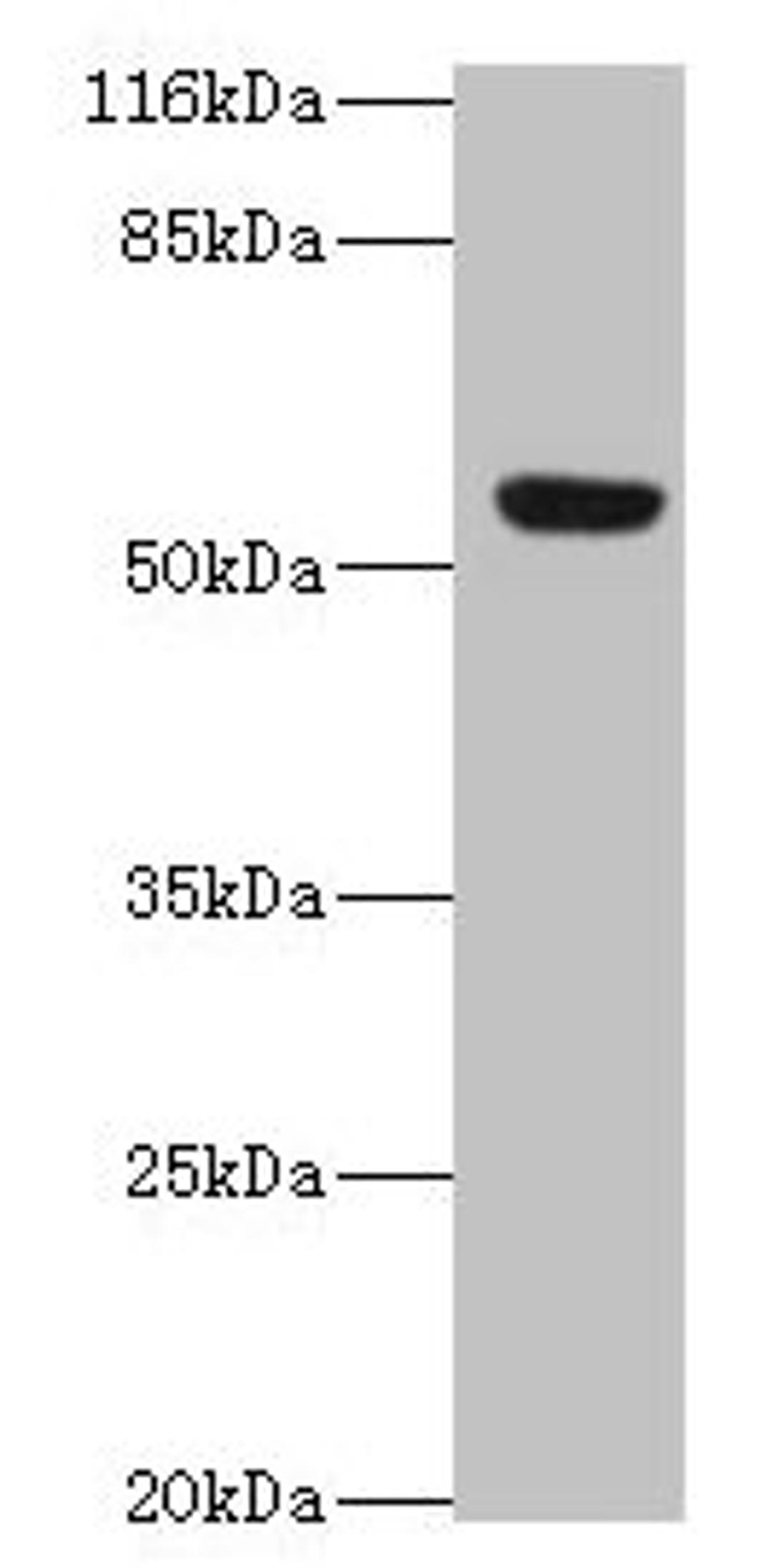 Western blot. All lanes: LILRA2 antibody at 4µg/ml + A549 whole cell lysate. Secondary. Goat polyclonal to rabbit IgG at 1/10000 dilution. Predicted band size: 53, 52, 47, 49 kDa. Observed band size: 53 kDa