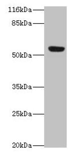Western blot. All lanes: LILRA2 antibody at 4µg/ml + A549 whole cell lysate. Secondary. Goat polyclonal to rabbit IgG at 1/10000 dilution. Predicted band size: 53, 52, 47, 49 kDa. Observed band size: 53 kDa