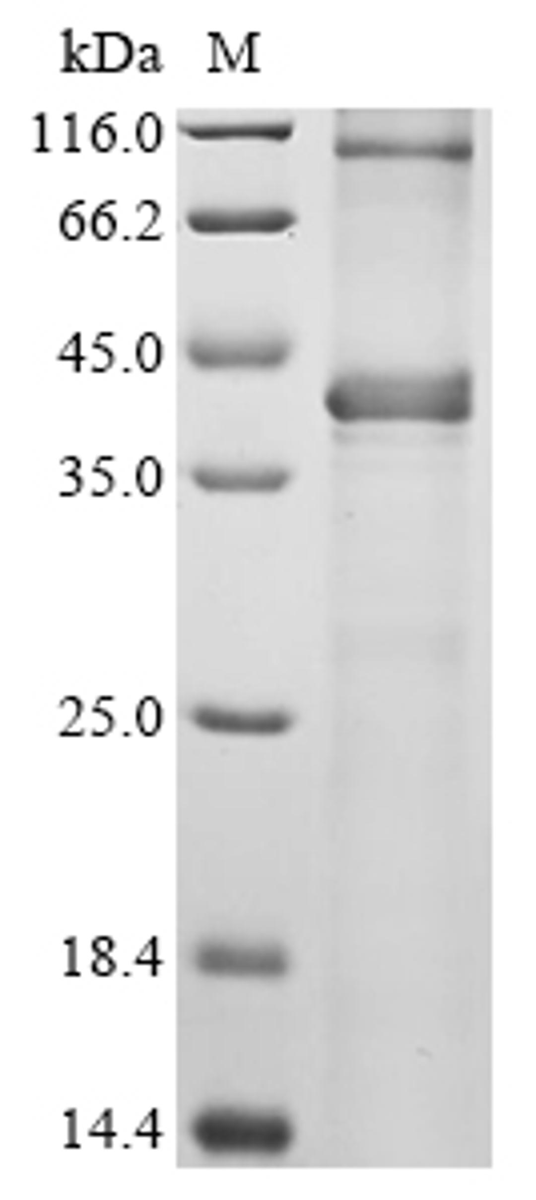 (Tris-Glycine gel) Discontinuous SDS-PAGE (reduced) with 5% enrichment gel and 15% separation gel.