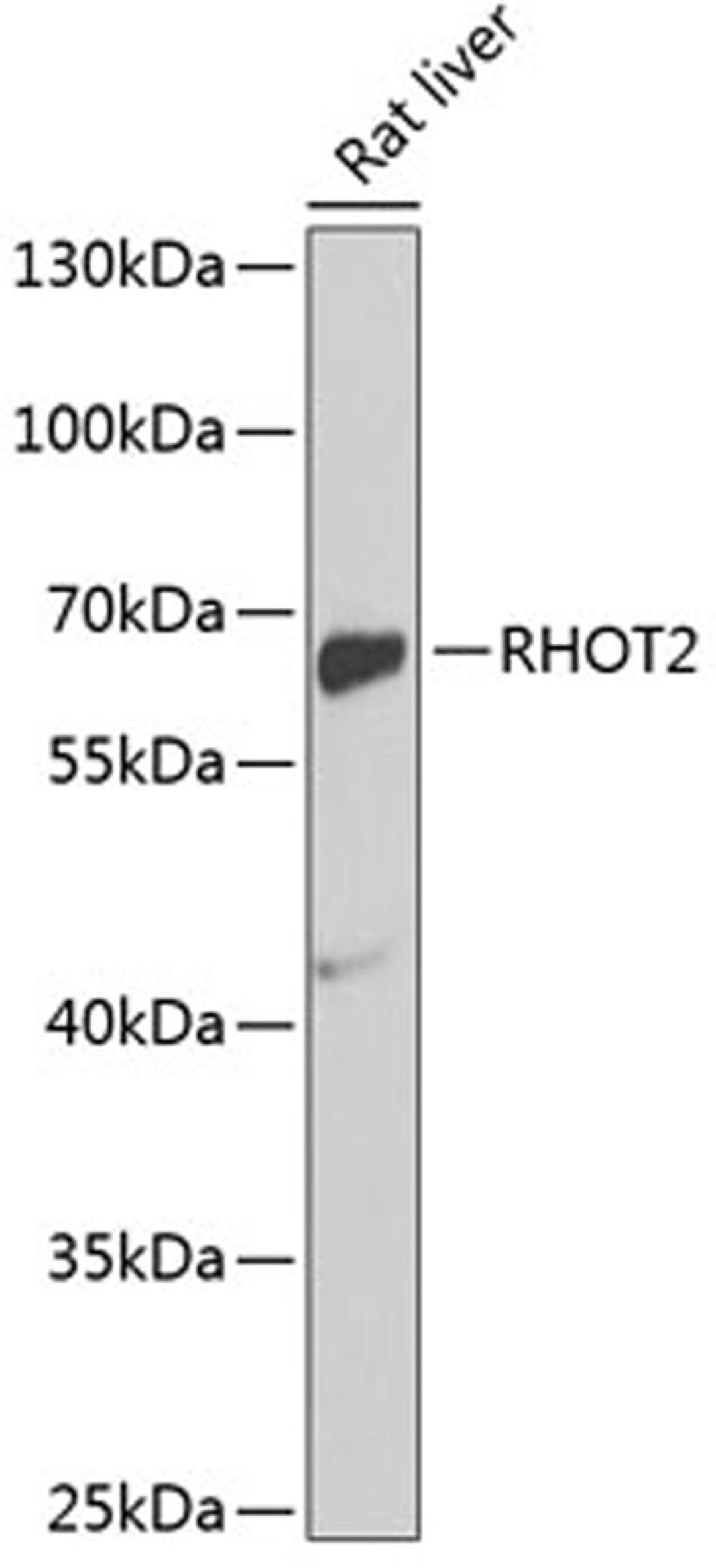 Western blot - RHOT2 antibody (A2597)