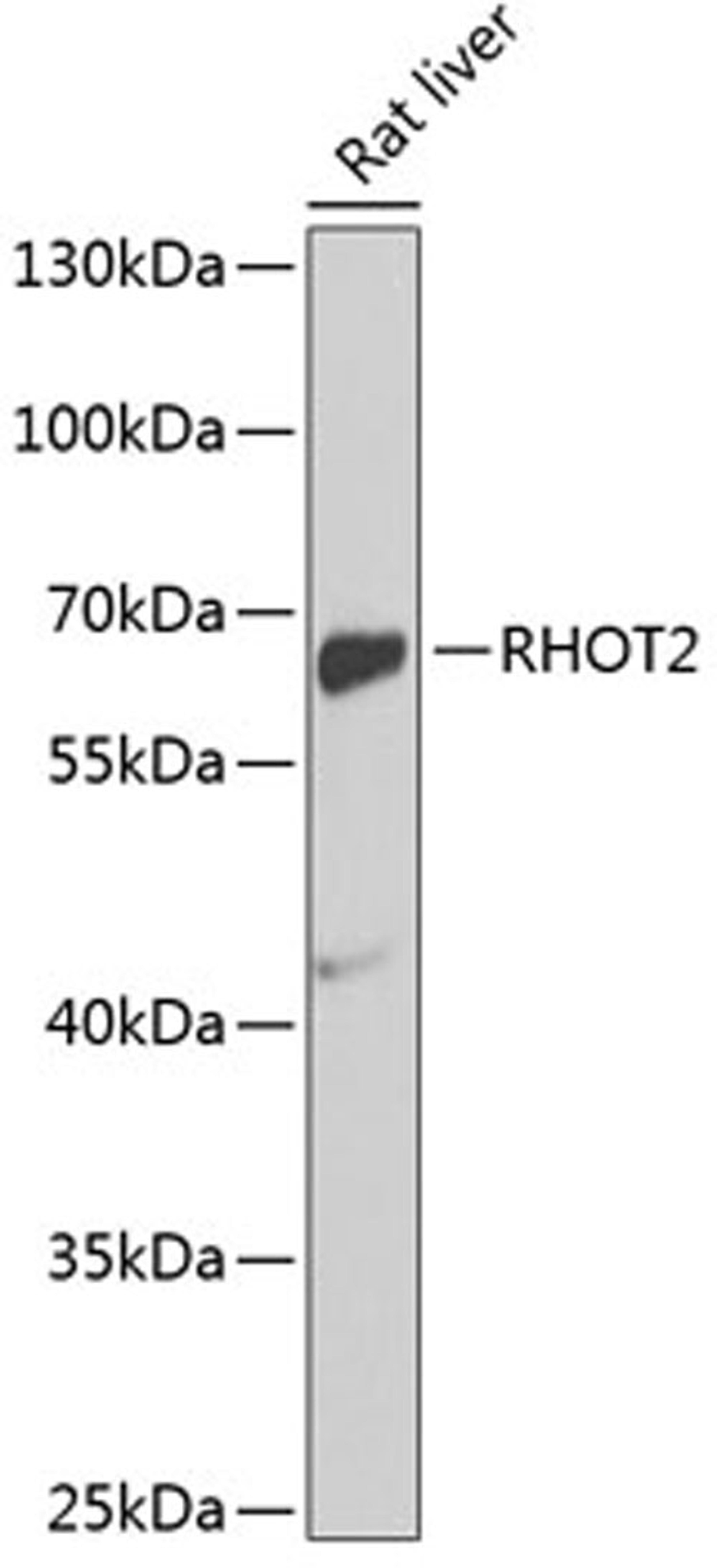 Western blot - RHOT2 antibody (A2597)