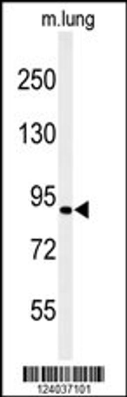 Western blot analysis of H6PD Antibody in mouse lung tissue lysates (35ug/lane)