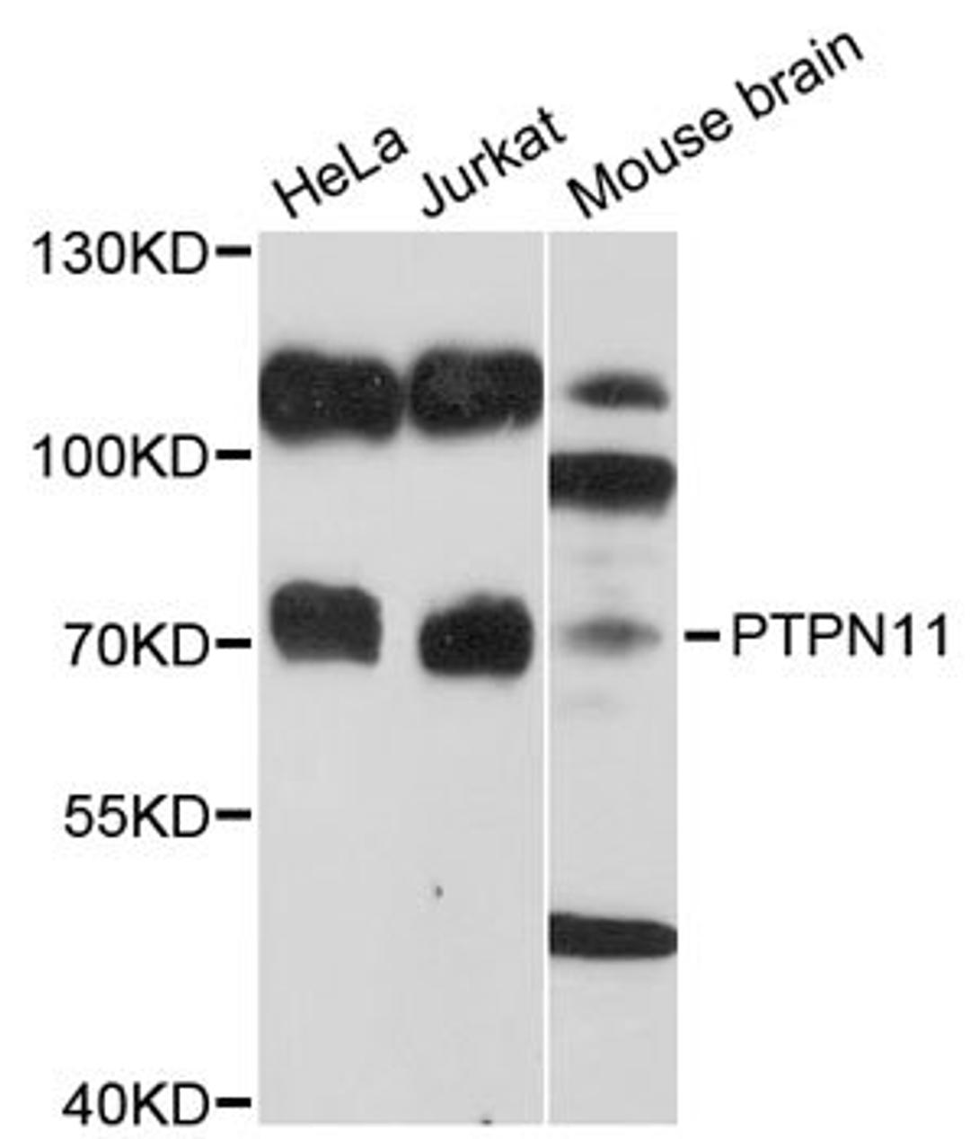 Western blot - PTPN11 antibody (A2793)