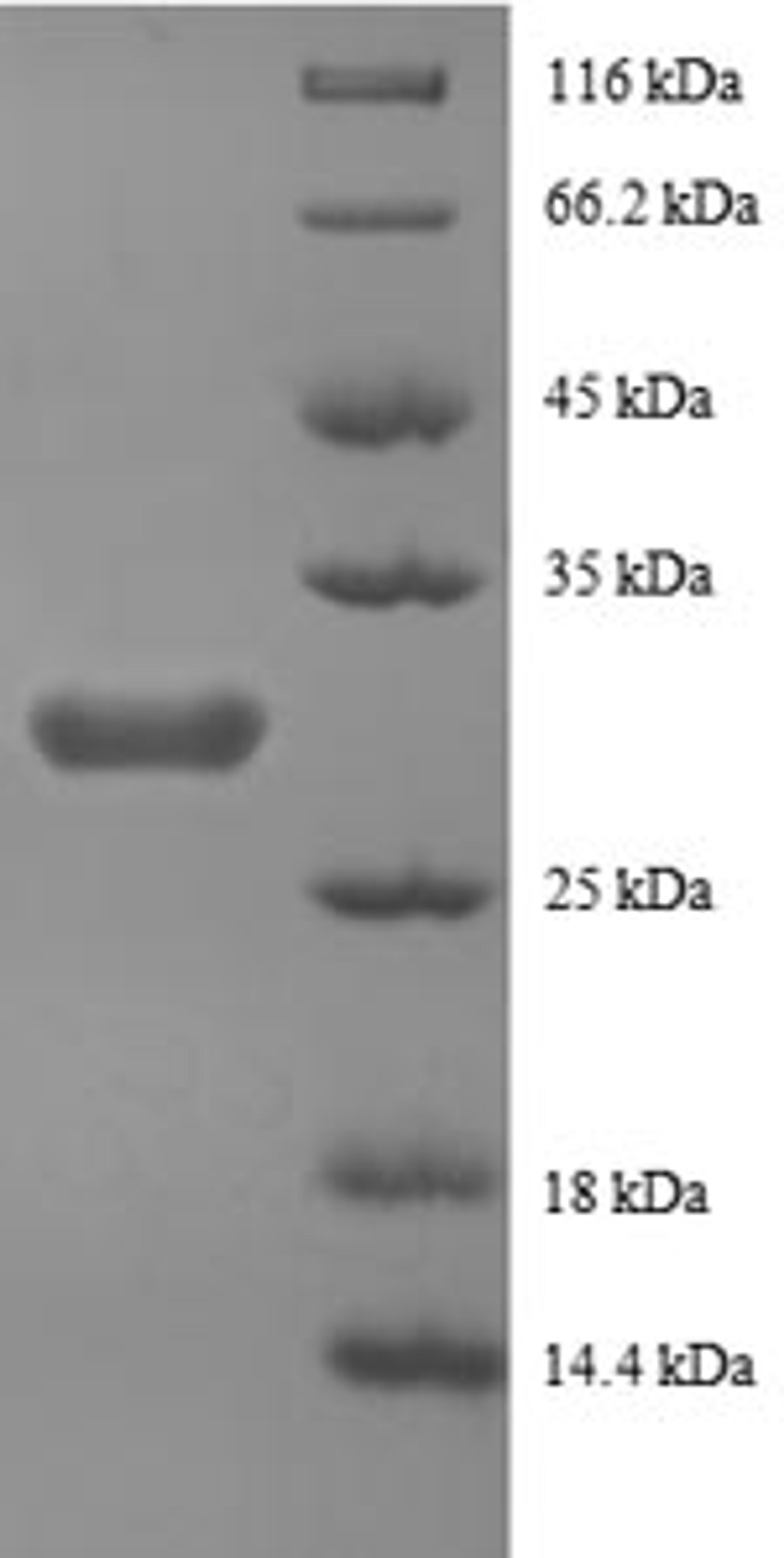 (Tris-Glycine gel) Discontinuous SDS-PAGE (reduced) with 5% enrichment gel and 15% separation gel.