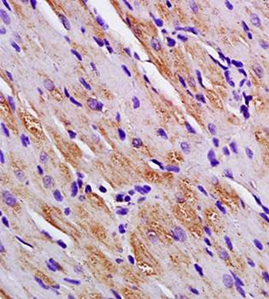 Paraffin-embedded rat heart tissue fixed with 4% paraformaldehyde. Antigen retrieval by boiling with citrate buffer. Blocking buffer is goat serum (37 degrees for 20 min.). Titin antibody at 1:200 dilution with overnight incubation at 4 degrees