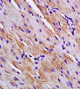 Paraffin-embedded rat heart tissue fixed with 4% paraformaldehyde. Antigen retrieval by boiling with citrate buffer. Blocking buffer is goat serum (37 degrees for 20 min.). Titin antibody at 1:200 dilution with overnight incubation at 4 degrees